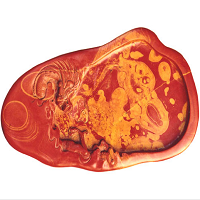 �ķ��ı�֮��˿��